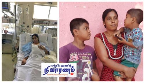 Chitra-before- -after-the-surgery-1024x587